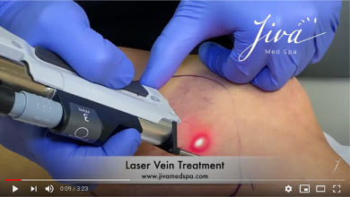 Vein Treatment